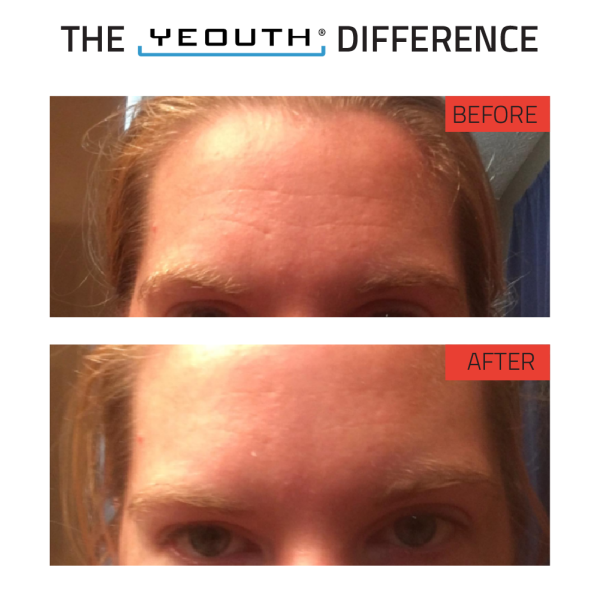 Retinol Serum For Discount - Image 5